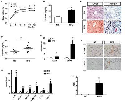 High Fat Diet Induces Kidney Injury via Stimulating Wnt/β-Catenin Signaling